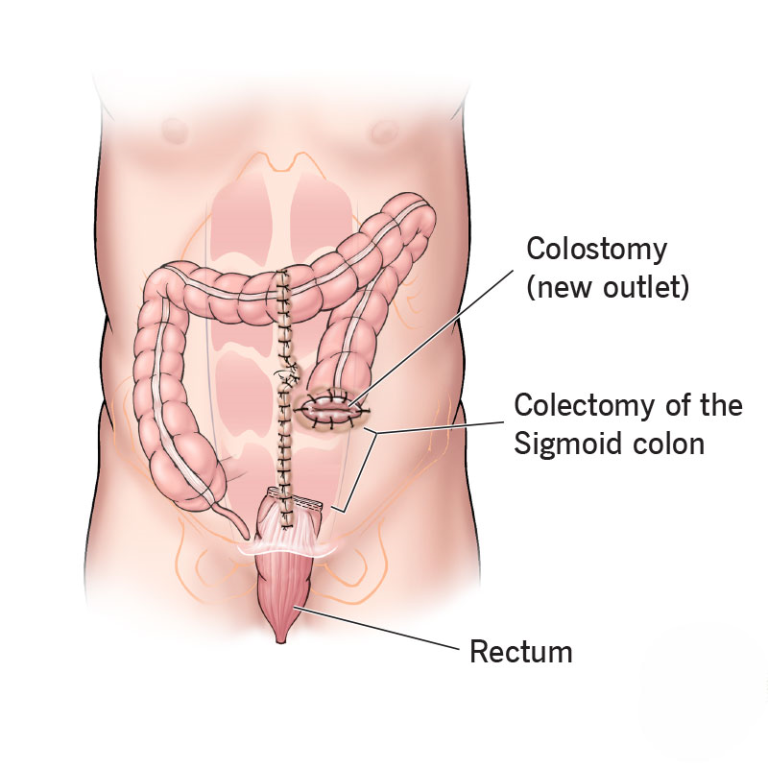 surgical gastrology 2